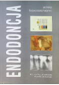Endodoncja