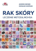 Rak skóry Leczenie metodą Mohsa