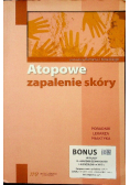 Atopowe zapalenie skóry. Poradnik lekarza praktyka