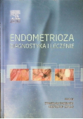 Endometrioza diagnostyka i leczenie