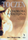 Toczeń choroba podstępna