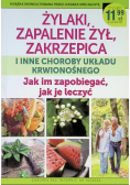 Żylaki zapalenie żył zakrzepica i inne choroby