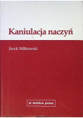 Kaniulacja naczyń