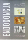 Endodoncja
