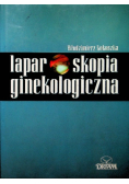 Laparoskopia ginekologiczna
