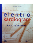 Elektrokardiogram bez tajemnic