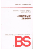 Usuwanie zębów