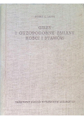 Guzy i guzopodobne zmiany kości i stawów