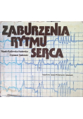 Zaburzenia rytmu serca