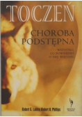 Toczeń choroba podstępna