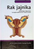 Rak jajnika patobiologia, diagnostyka i przegląd współczesnych metod leczenia