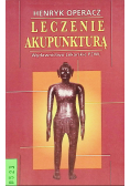 Leczenie akupunkturą