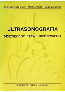 Ultrasonografia dziecięcego stawu biodrowego