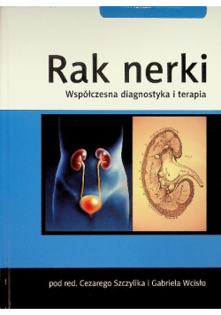 Rak nerki - Współczesna doagnostyka i terapia