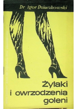 Żylaki i owrzodzenia goleni