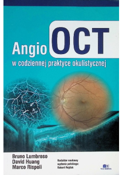 Angio OCT w codziennej praktyce okulistycznej