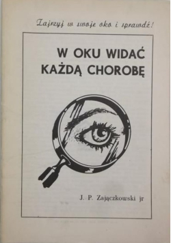 W oku widać każdą chorobę