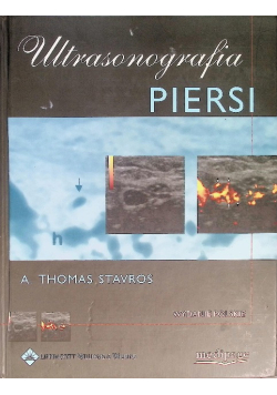 Ultrasonografia piersi