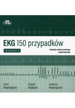 EKG 150 przypadków