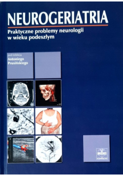 Neurogeriatria Praktyczne problemy neurologii w wieku podeszłym