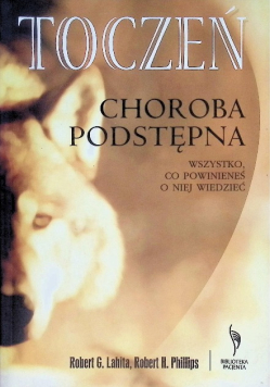 Toczeń choroba podstępna