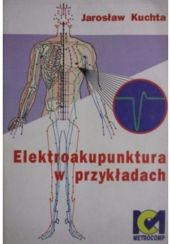 Elektroakupunktura w przykładach