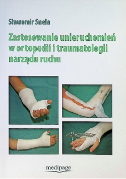 Zastosowanie Unieruchomień w Ortopedii i Traumatologii Narządu Ruchu