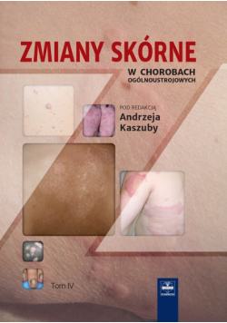Zmiany skórne w chorobach ogólnoustrojowych Tom 4