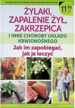 Żylaki zapalenie żył zakrzepica i inne choroby