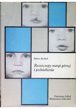 Rozszczepy wargi górnej i podniebienia