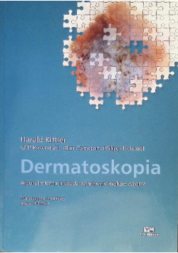 Dermatoskopia algorytmiczna metoda oparta na analizie wzorca