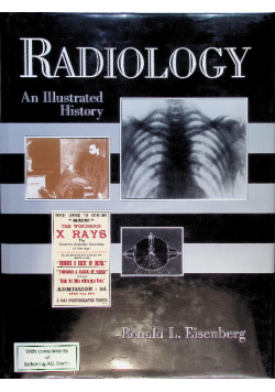 Radiology An Illustrated History
