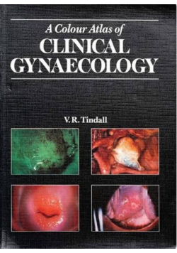 A Colour Atlas of Clinical Gynaecology