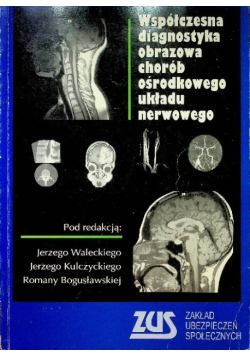 Współczesna diagnostyka obrazowa chorób ośrodkowego układu nerwowego