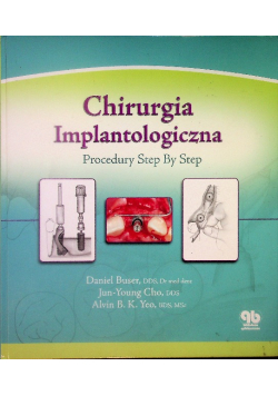 Chirurgia implantologiczna