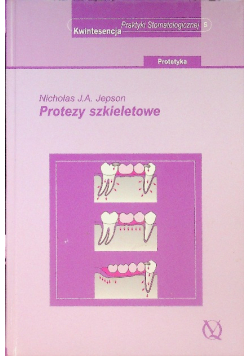 Protezy szkieletowe