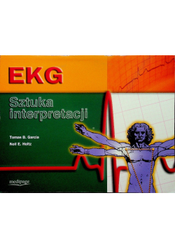 EKG sztuka interpretacji