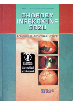Choroby infekcyjne oczu