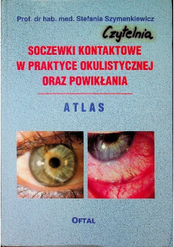 Soczewki kontaktowe w praktyce okulistycznej oraz powikłania