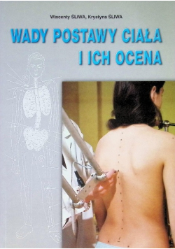 Wady postawy ciała i ich ocena