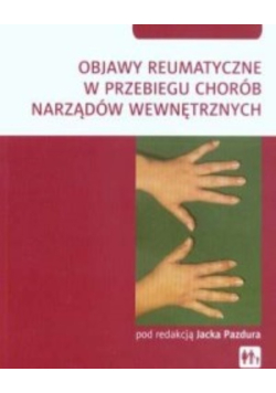 Objawy reumatyczne w przebiegu chorób narządów wewnętrznych