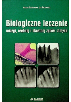 Biologiczne leczenie miazgi ozębnej i okostnej zębów stałych