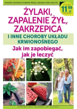 Żylaki zapalenie żył zakrzepica i inne choroby
