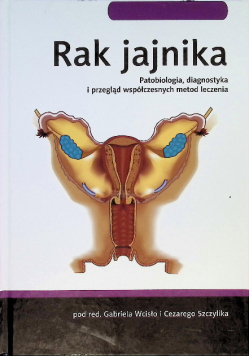 Rak jajnika patobiologia, diagnostyka i przegląd współczesnych metod leczenia