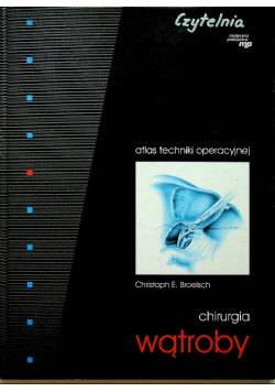 Chirurgia wątroby